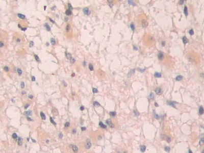 Polyclonal Antibody to Interleukin 1 Receptor Type I (IL1R1)