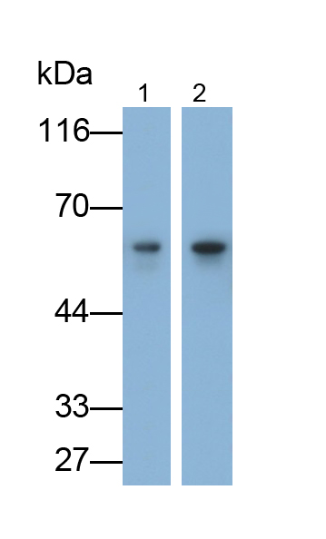 Polyclonal Antibody to Interleukin 1 Receptor Type I (IL1R1)