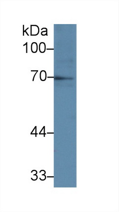 Polyclonal Antibody to Interleukin 1 Receptor Type I (IL1R1)