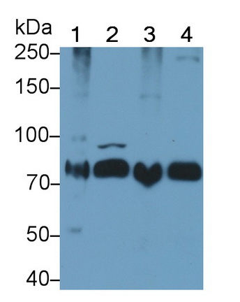 Polyclonal Antibody to Interleukin 1 Receptor Type I (IL1R1)