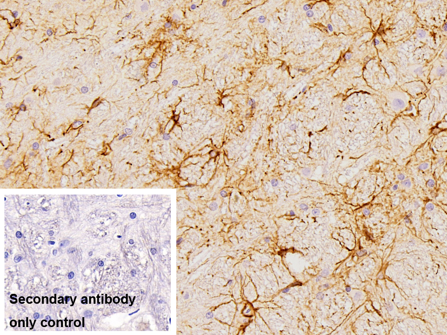 Polyclonal Antibody to Glial Fibrillary Acidic Protein (GFAP)