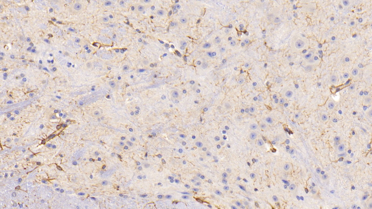 Polyclonal Antibody to Glial Fibrillary Acidic Protein (GFAP)