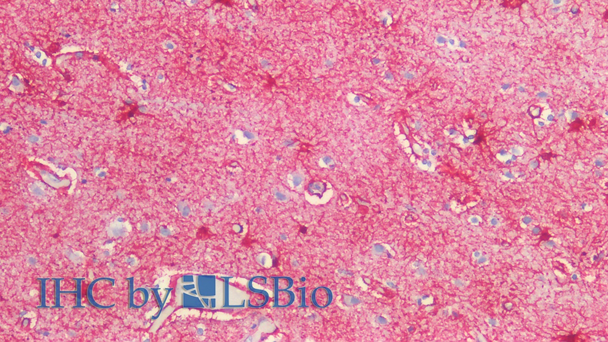 Polyclonal Antibody to Glial Fibrillary Acidic Protein (GFAP)