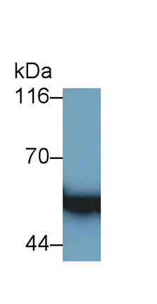 Polyclonal Antibody to Glial Fibrillary Acidic Protein (GFAP)