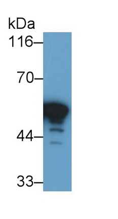 Polyclonal Antibody to Glial Fibrillary Acidic Protein (GFAP)