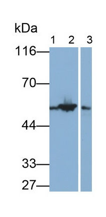 Polyclonal Antibody to Glial Fibrillary Acidic Protein (GFAP)