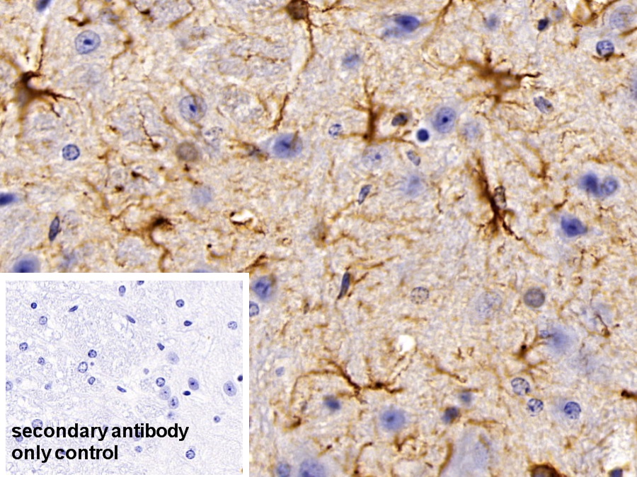 Polyclonal Antibody to Glial Fibrillary Acidic Protein (GFAP)