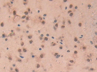 Polyclonal Antibody to Glial Fibrillary Acidic Protein (GFAP)