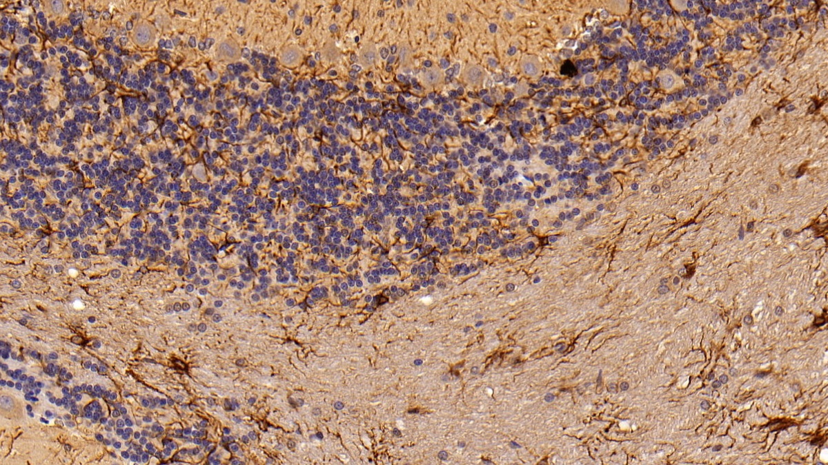 Polyclonal Antibody to Glial Fibrillary Acidic Protein (GFAP)
