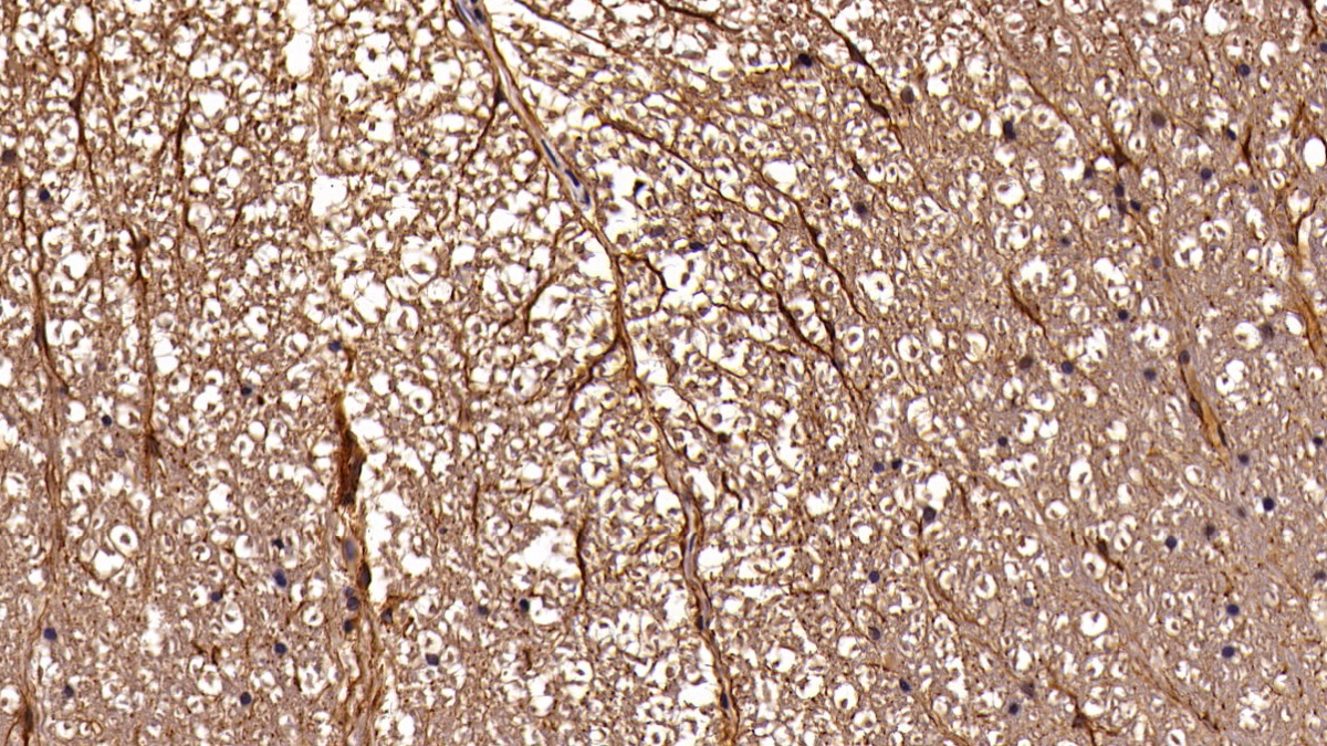 Polyclonal Antibody to Glial Fibrillary Acidic Protein (GFAP)