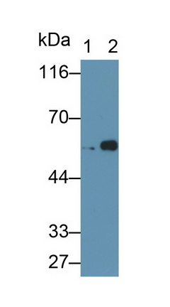 Polyclonal Antibody to Glial Fibrillary Acidic Protein (GFAP)