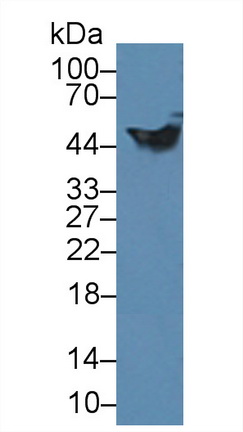 Polyclonal Antibody to Glial Fibrillary Acidic Protein (GFAP)