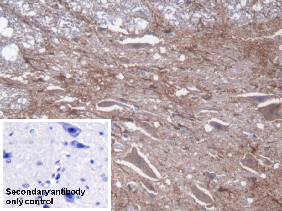 Polyclonal Antibody to Glial Fibrillary Acidic Protein (GFAP)