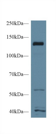 Polyclonal Antibody to Meningioma Expressed Antigen 5 (MGEA5)