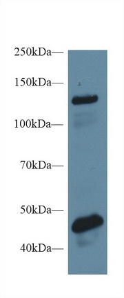 Polyclonal Antibody to Meningioma Expressed Antigen 5 (MGEA5)