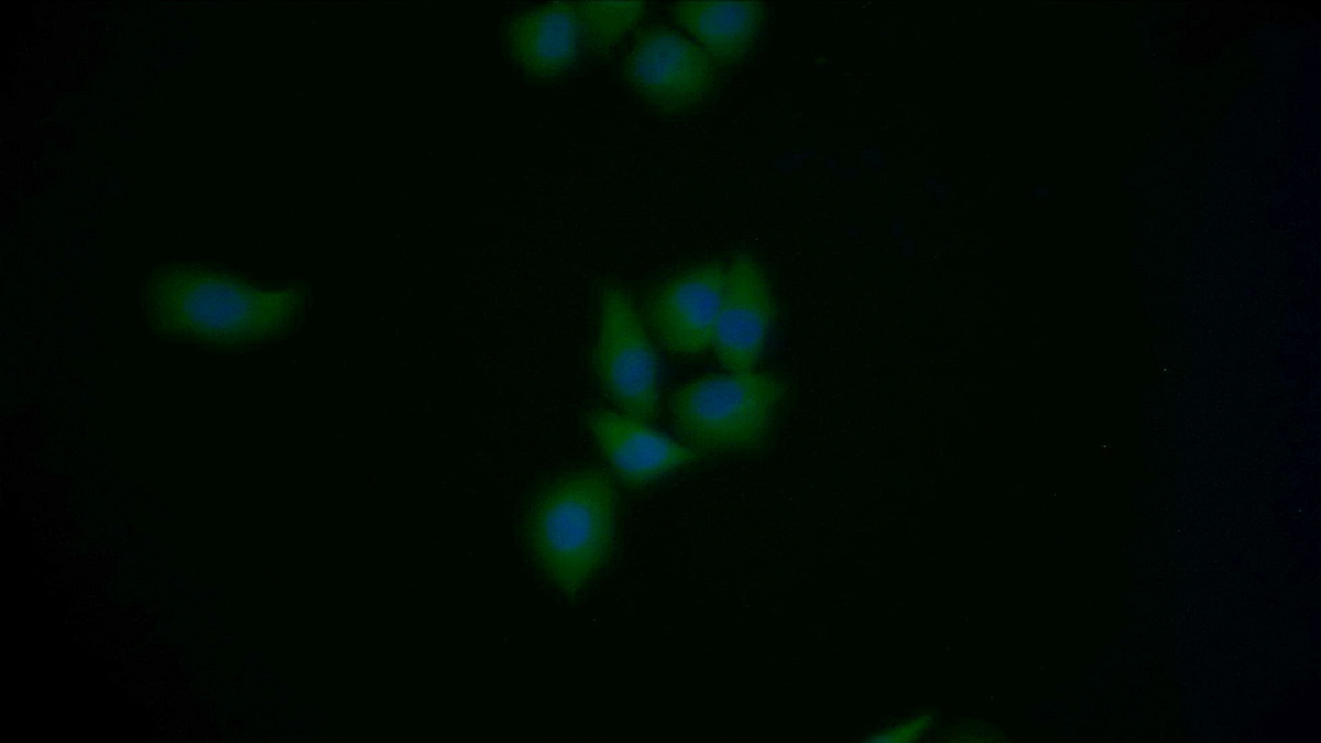 Polyclonal Antibody to Meningioma Expressed Antigen 5 (MGEA5)