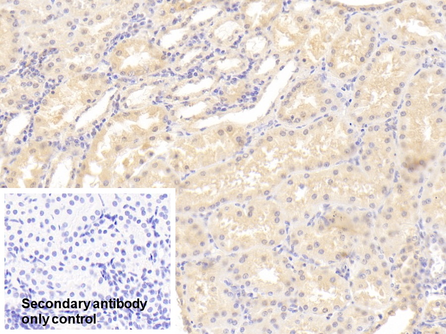 Polyclonal Antibody to Meningioma Expressed Antigen 5 (MGEA5)