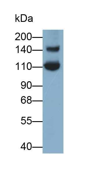 Polyclonal Antibody to Meningioma Expressed Antigen 5 (MGEA5)