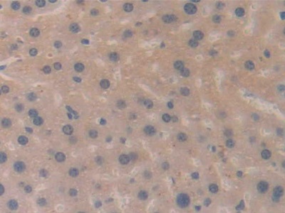 Polyclonal Antibody to Meningioma Expressed Antigen 5 (MGEA5)