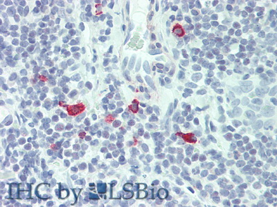 Polyclonal Antibody to Interleukin 3 (IL3)