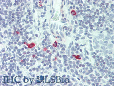 Polyclonal Antibody to Interleukin 3 (IL3)