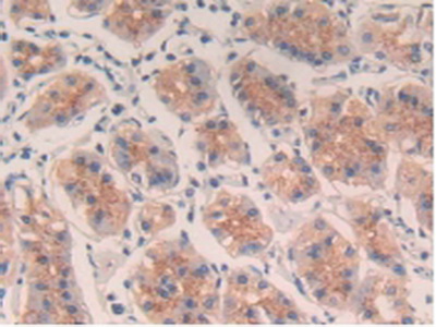 Polyclonal Antibody to Interleukin 4 (IL4)