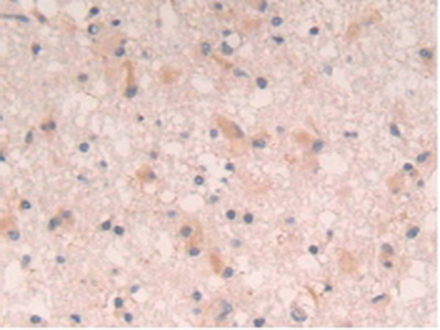 Polyclonal Antibody to Interleukin 4 (IL4)