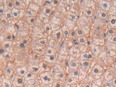 Polyclonal Antibody to Interleukin 4 (IL4)