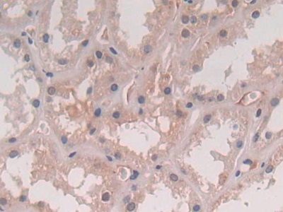 Polyclonal Antibody to Interleukin 5 (IL5)