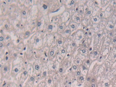 Polyclonal Antibody to Interleukin 5 (IL5)