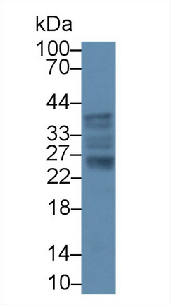 Polyclonal Antibody to Interleukin 6 (IL6)