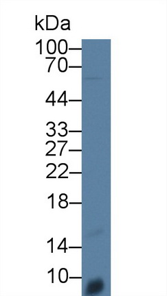 Polyclonal Antibody to Interleukin 8 (IL8)