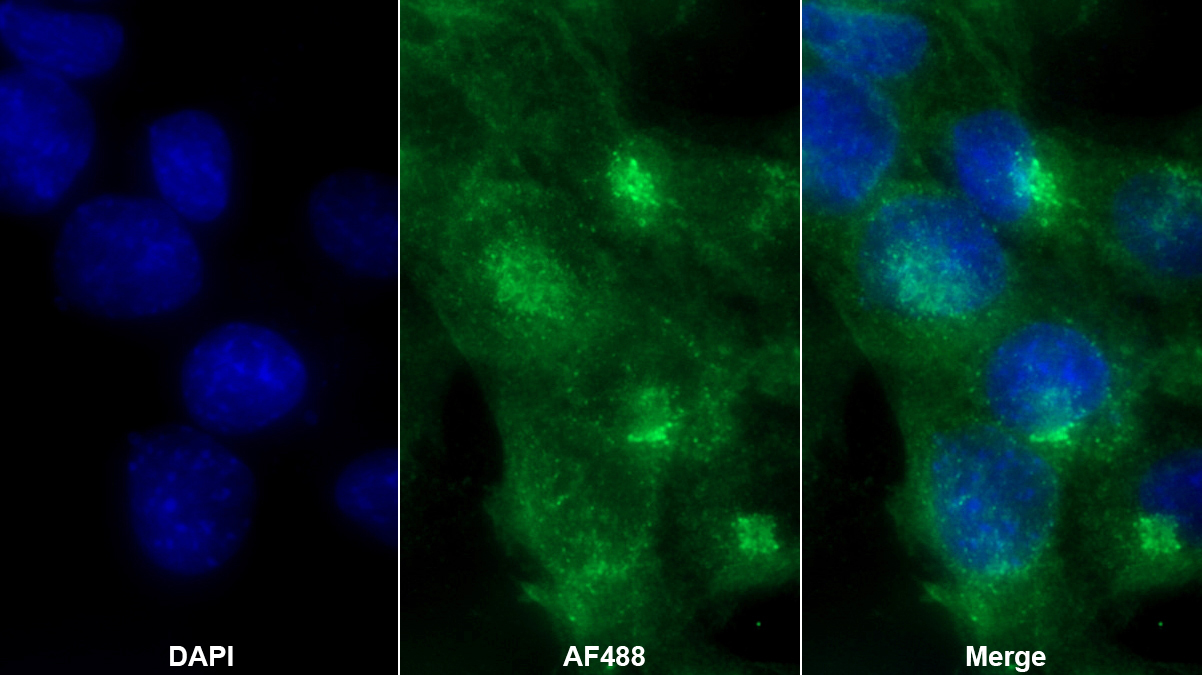 Polyclonal Antibody to Laminin (LN)