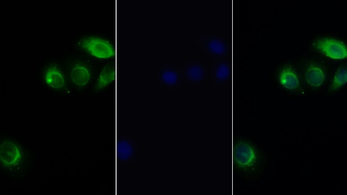 Polyclonal Antibody to Leptin Receptor (LEPR)