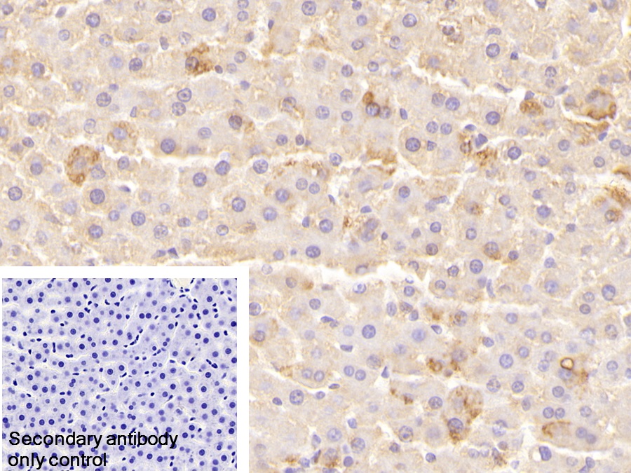 Polyclonal Antibody to Leptin Receptor (LEPR)