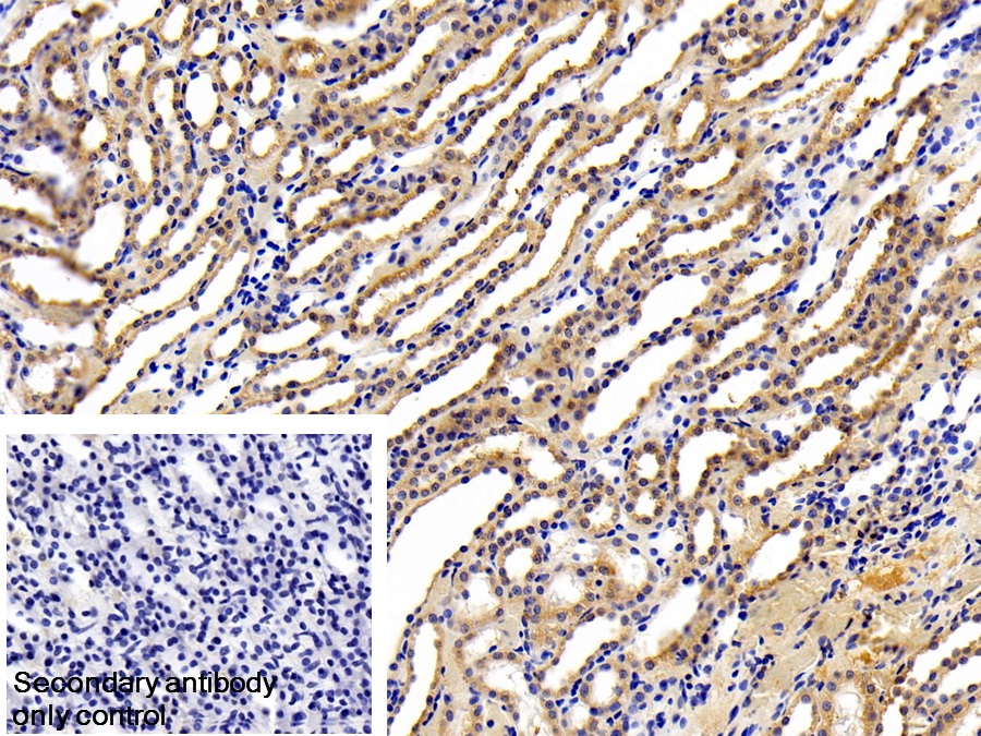 Polyclonal Antibody to Leptin Receptor (LEPR)