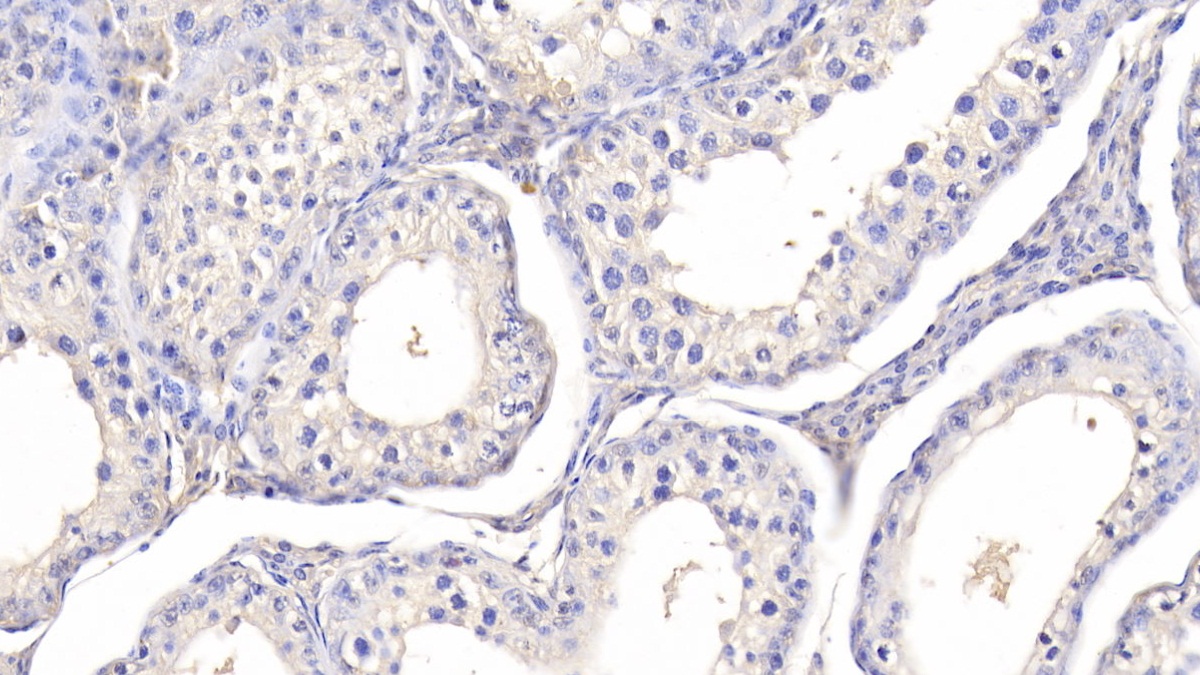 Polyclonal Antibody to Leptin (LEP)