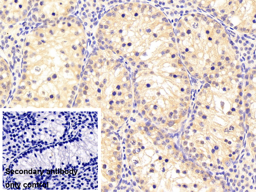 Polyclonal Antibody to Leptin (LEP)