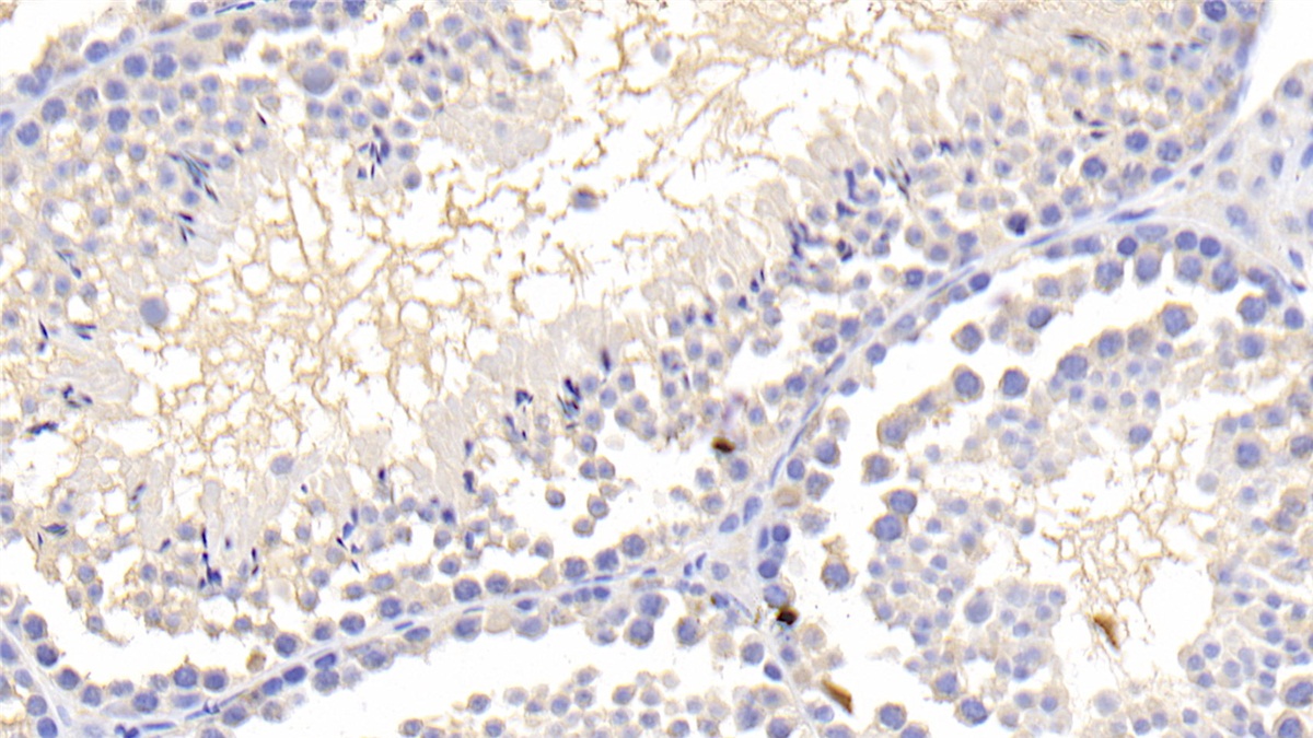 Polyclonal Antibody to Leptin (LEP)