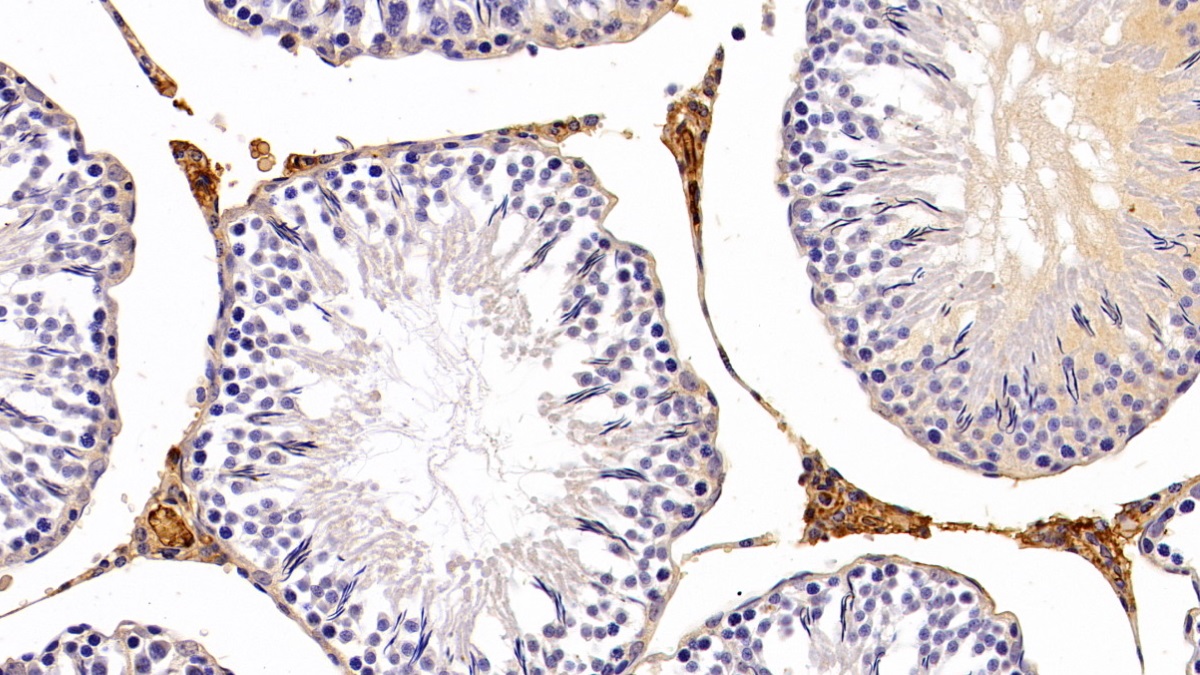 Polyclonal Antibody to Leptin (LEP)