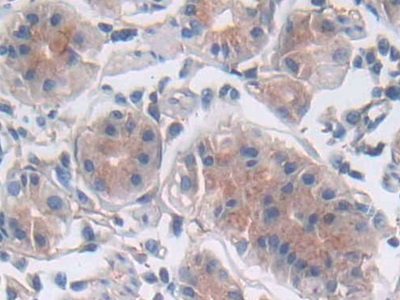 Polyclonal Antibody to Leukemia Inhibitory Factor (LIF)