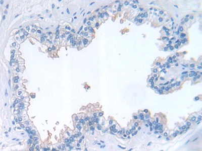 Polyclonal Antibody to Leukemia Inhibitory Factor (LIF)