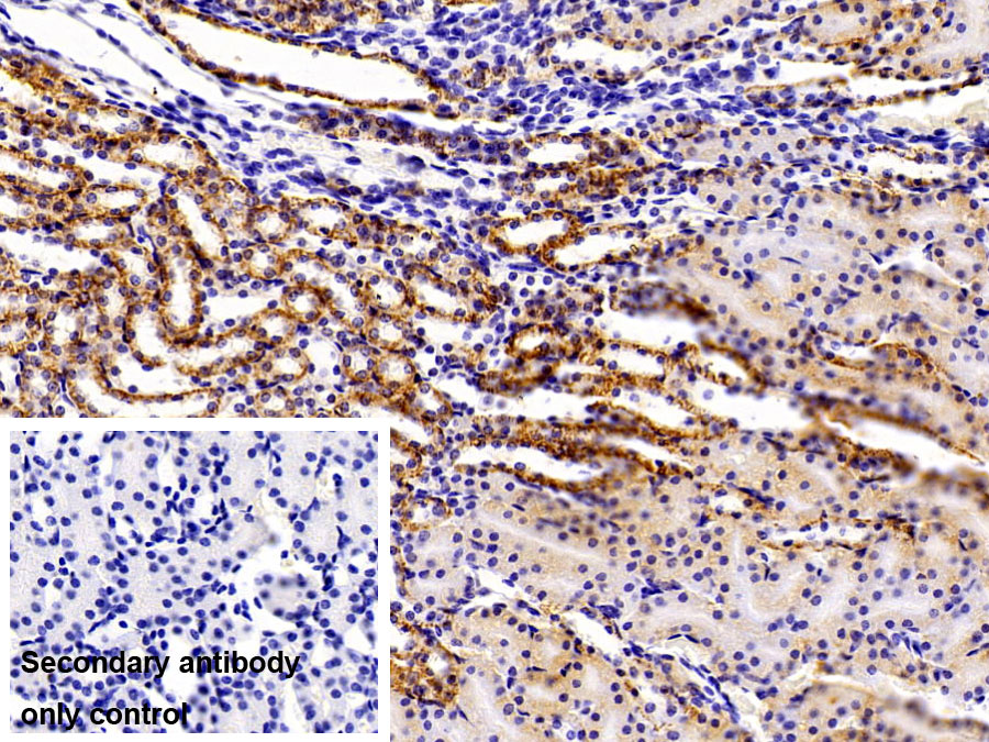 Polyclonal Antibody to Monocyte Chemotactic Protein 1 (MCP1)