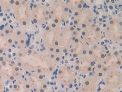 Polyclonal Antibody to Macrophage Inflammatory Protein 1 Beta (MIP1b)