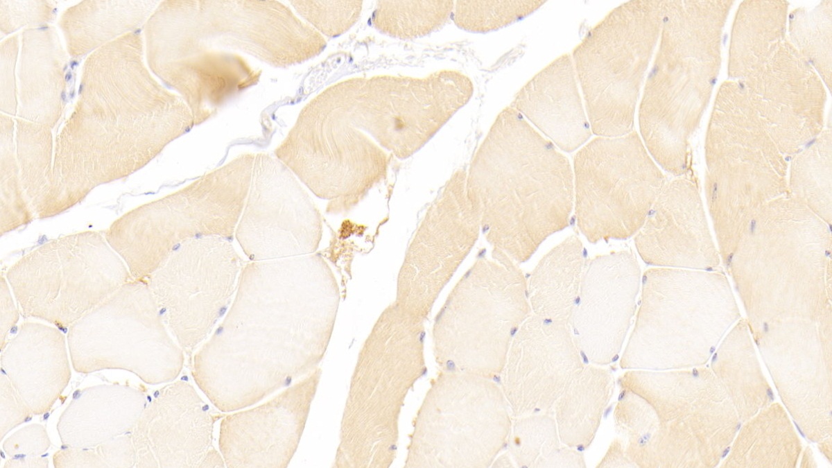 Polyclonal Antibody to Matrix Metalloproteinase 1 (MMP1)