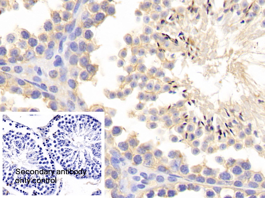 Polyclonal Antibody to Matrix Metalloproteinase 1 (MMP1)