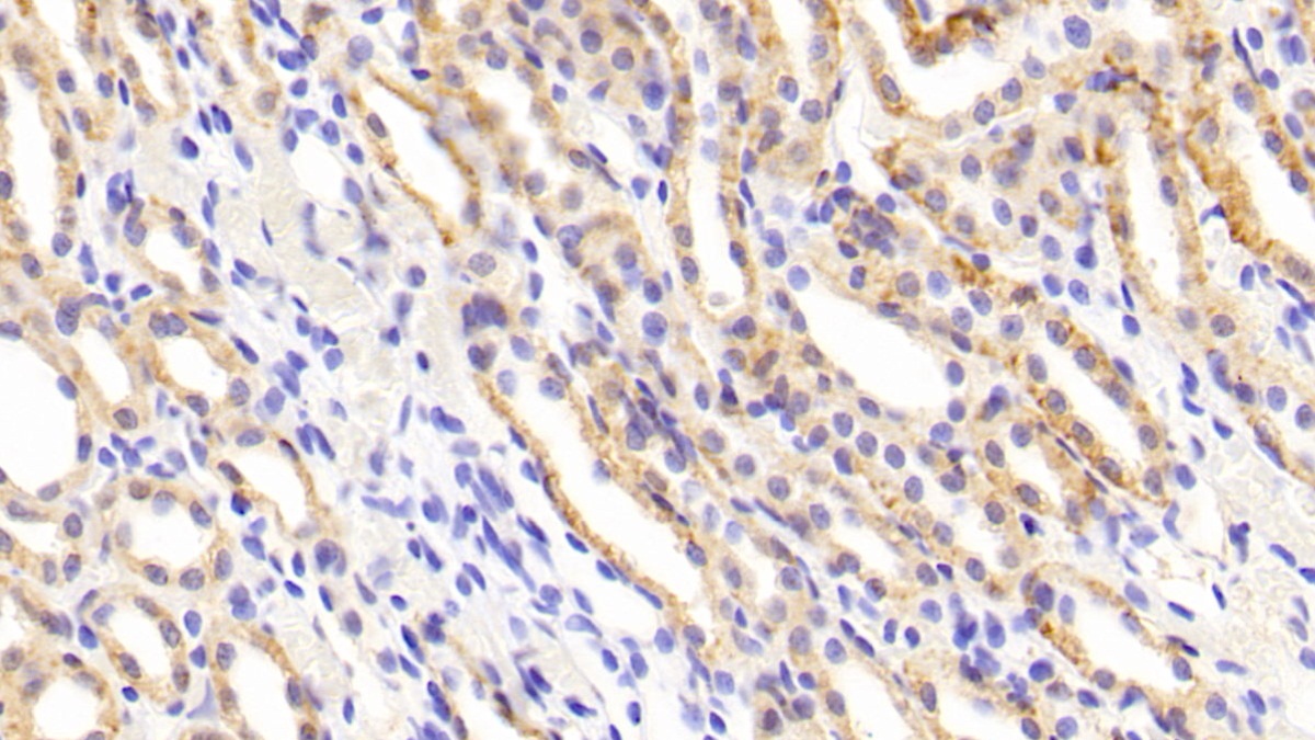 Polyclonal Antibody to Matrix Metalloproteinase 1 (MMP1)