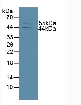 Polyclonal Antibody to Matrix Metalloproteinase 13 (MMP13)