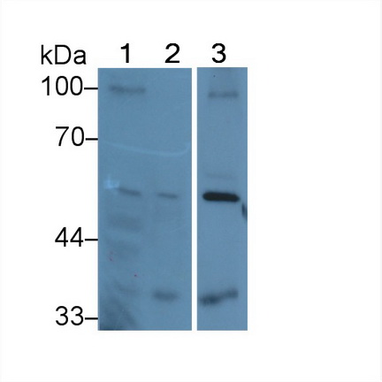 Polyclonal Antibody to Matrix Metalloproteinase 13 (MMP13)