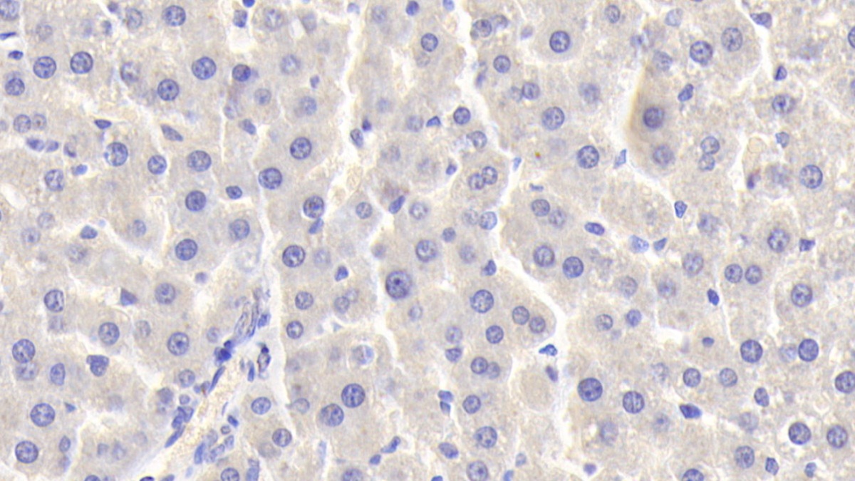 Polyclonal Antibody to Matrix Metalloproteinase 13 (MMP13)